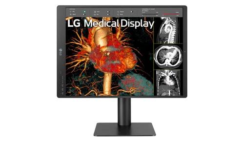 LG 21.3-Inch 2MP Diagnostic Medical Radiology Display (21HQ513D)